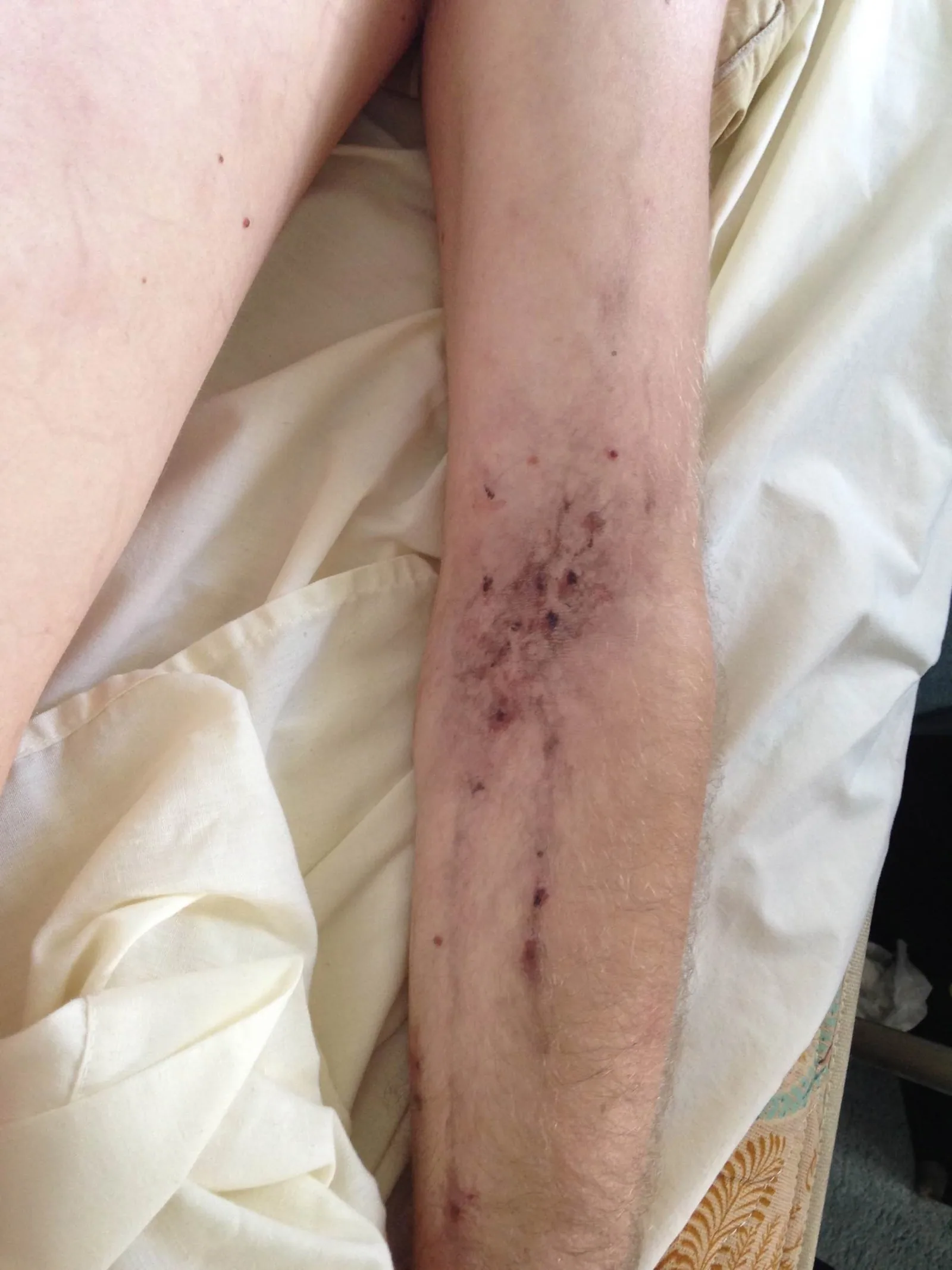 Track marks for "HOKE" TV pilot