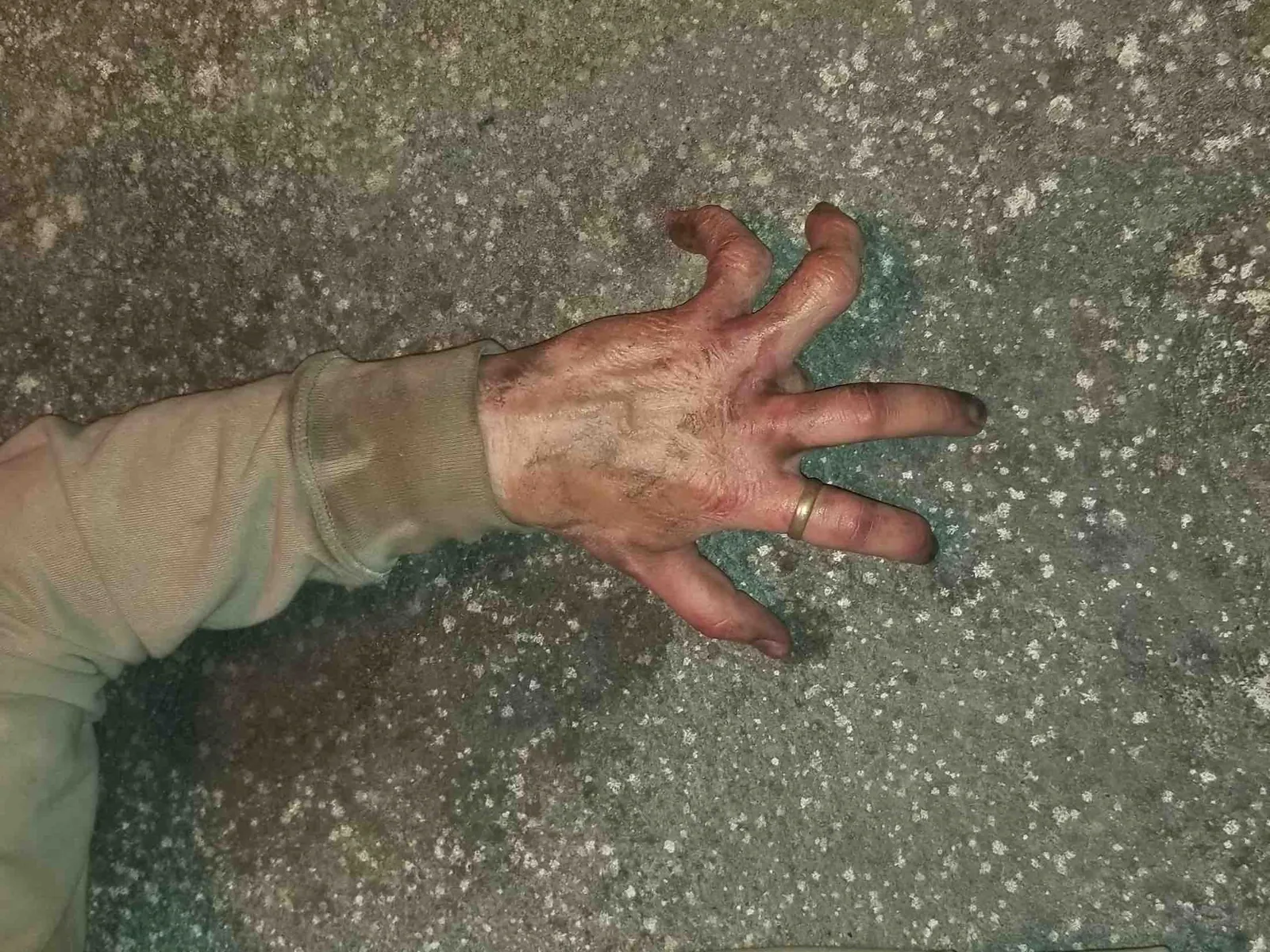 Broken Fingers on Tom Hardy body double for "Venom"