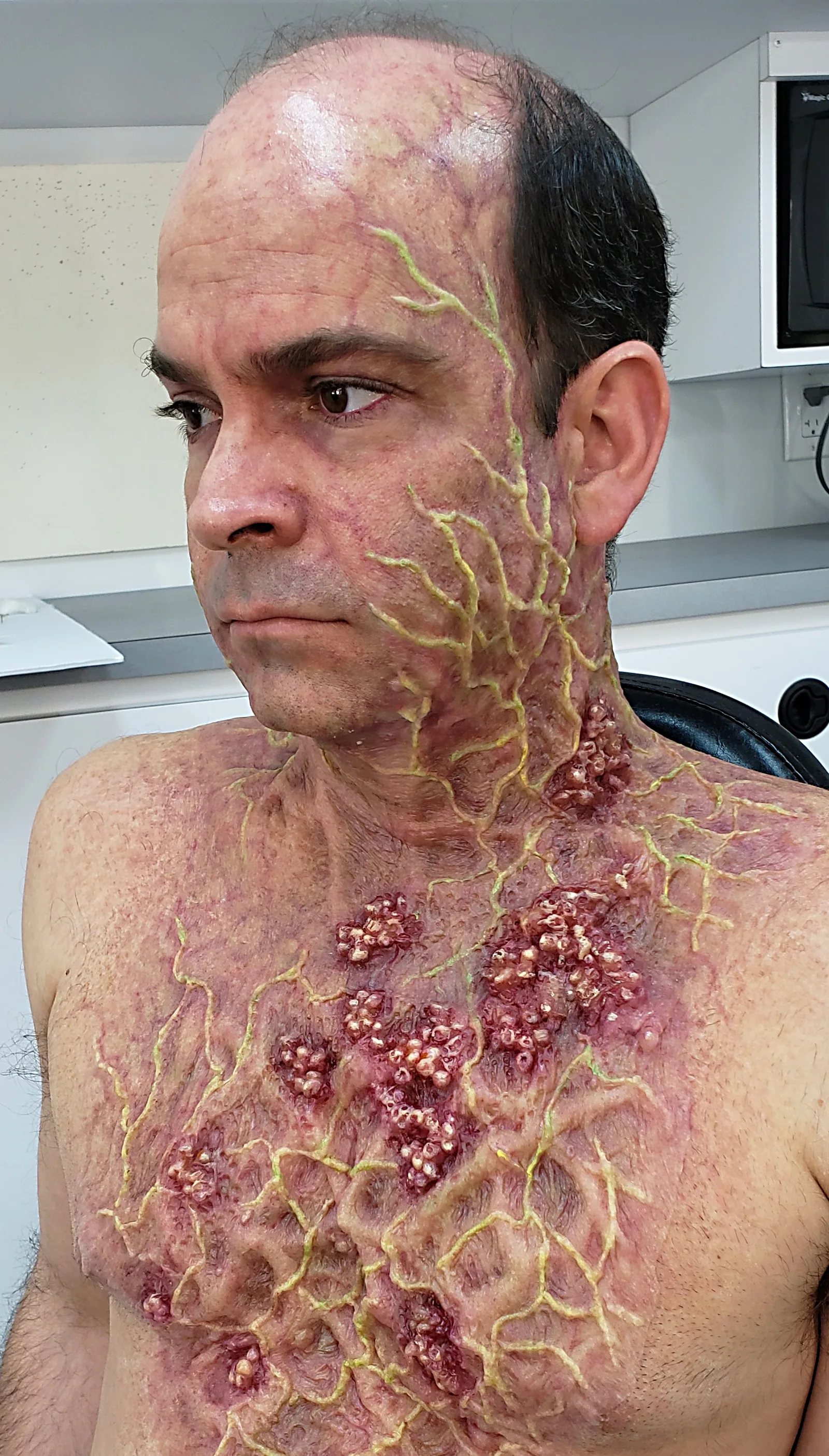 Disease Makeup for Raising Dion